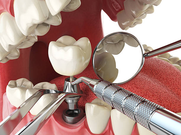 Best Orthodontic Emergency Dentist in Konawa, OK